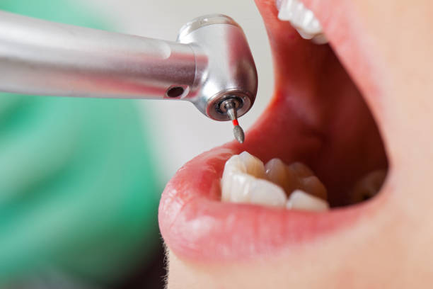 Best Emergency Gum Treatment in Sweet Home, OR